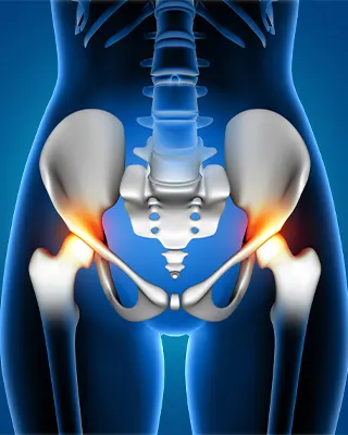 img-artroscopia-de-cadera-en-bogota-1-LCP