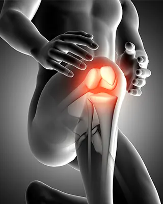 img-artroscopia-de-rodilla-en-bogota-1-LCP