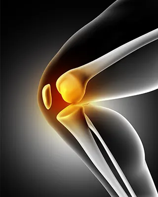 img-cirugia-de-protesis-de-rodilla-en-bogota-1-LCP