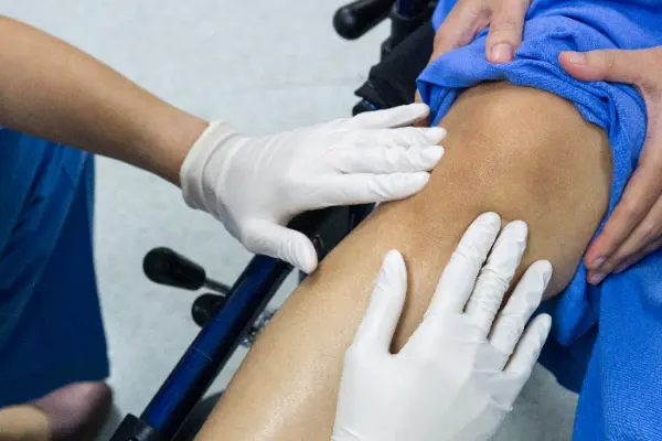 Luego de una artroscopia de rodilla, una de las preguntas más frecuentes es cuál es el tiempo para caminar después de una artroscopia de rodilla. La inquietud por volver a...